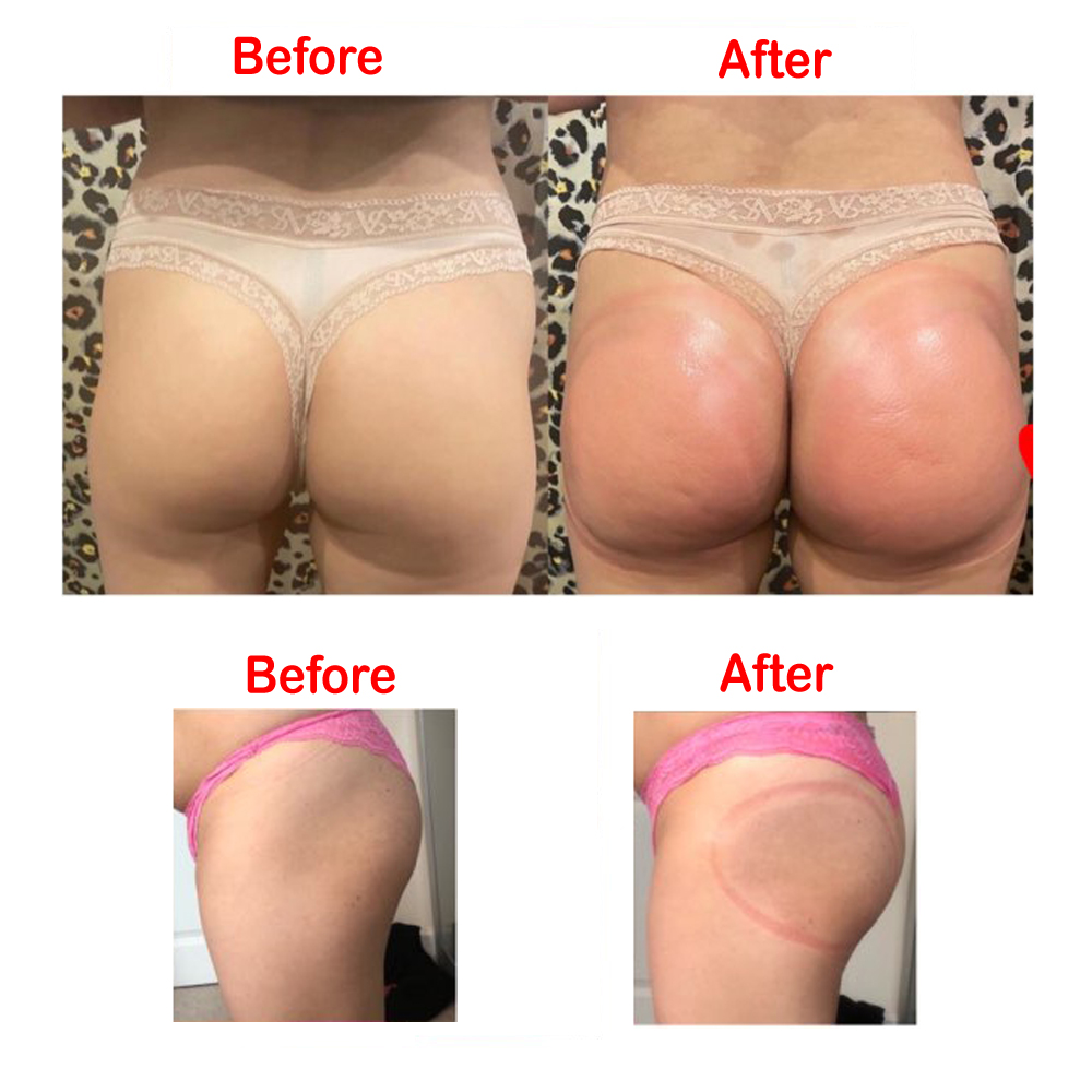 VamsLuna – ventouse pour fesse - Breast Pump avis et prix
